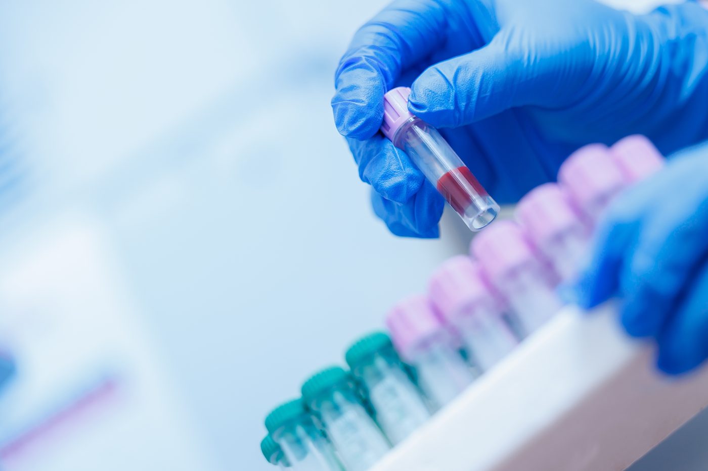 Blood sample tubes being handled in a laboratory
