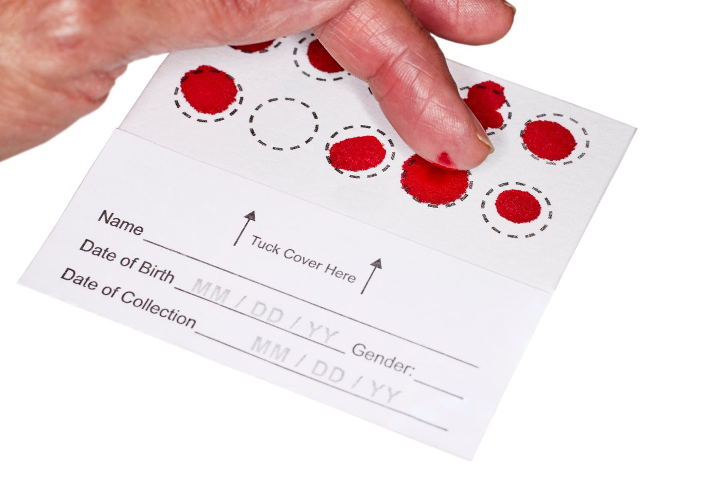 A blood spot card with several circles filled from a finger-prick